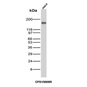 CPS1 Antibody in Western Blot (WB)