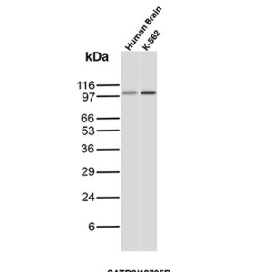 SATB2 Antibody in Western Blot (WB)