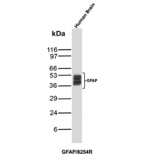 GFAP Antibody in Western Blot (WB)