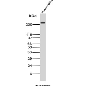 Tenascin C Antibody in Western Blot (WB)