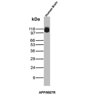 Amyloid, beta / APP Antibody in Western Blot (WB)