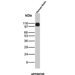 Amyloid, beta / APP Antibody in Western Blot (WB)