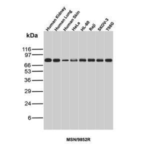 Moesin Antibody in Western Blot (WB)