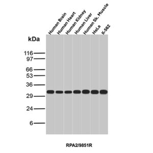 Replication Protein A2 Antibody in Western Blot (WB)