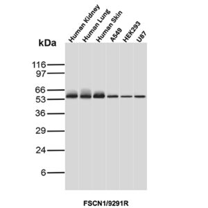 Fascin-1 Antibody in Western Blot (WB)