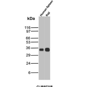 CD74 Antibody in Western Blot (WB)