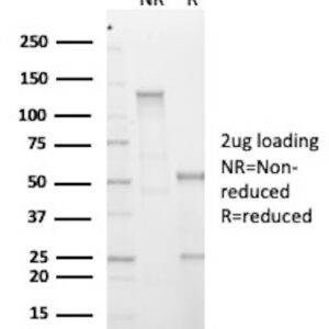 Phosphotyrosine Antibody in SDS-PAGE