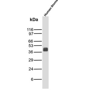 Podoplanin Antibody in Western Blot (WB)