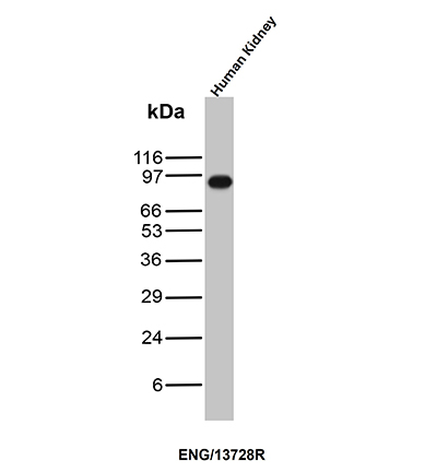 Western blot analysis of human kidney tissue lysate using CD105 Recombinant Rabbit Monoclonal Antibody (ENG/13728R). CD105 Antibody in Western Blot (WB)