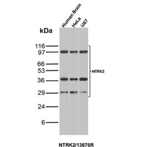NTRK2 (Neurotrophic Receptor Tyrosine Kinase 2) Antibody in Western Blot (WB)