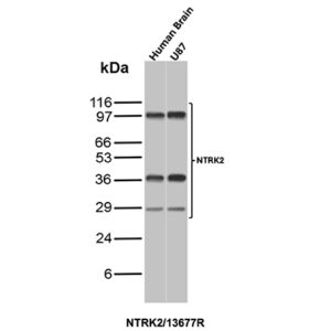NTRK2 (Neurotrophic Receptor Tyrosine Kinase 2) Antibody in Western Blot (WB)