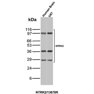 NTRK2 (Neurotrophic Receptor Tyrosine Kinase 2) Antibody in Western Blot (WB)