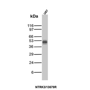 NTRK3 (Neurotrophic Receptor Tyrosine Kinase 3) Antibody in Western Blot (WB)