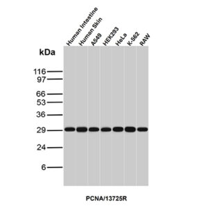 PCNA (Proliferating Cell Nuclear Antigen) (G1- & S-phase Marker) Antibody in Western Blot (WB)