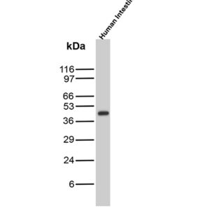 Cytokeratin 20 Antibody in Western Blot (WB)