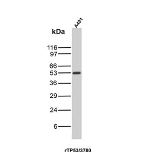 p53 Antibody in Western Blot (WB)