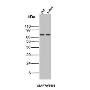 ZAP70 Antibody in Western Blot (WB)