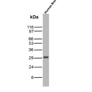 Calretinin Antibody in Western Blot (WB)