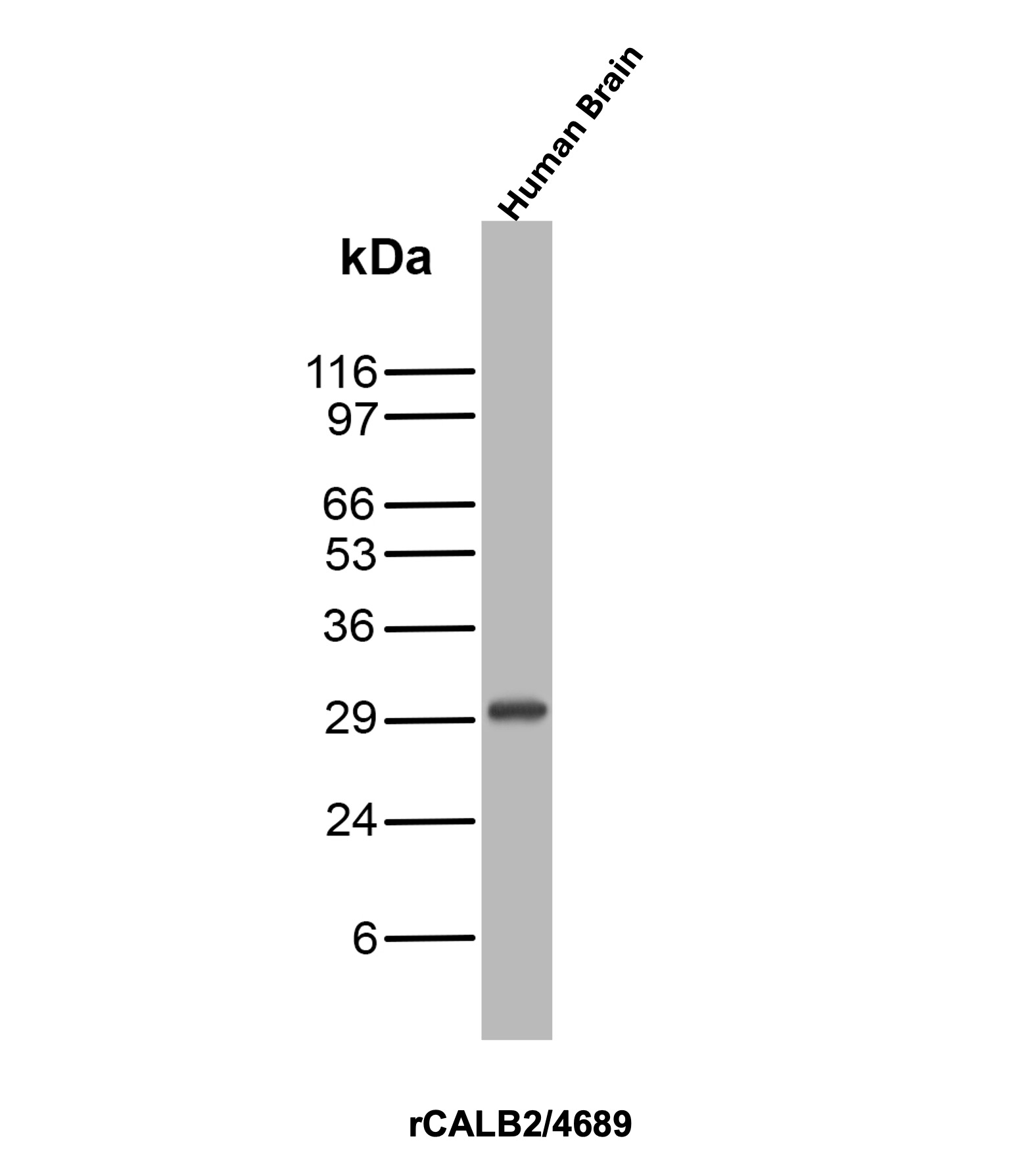 Western Blot Analysis of Human Brain tissue lysate using Calretinin Recombinant Mouse Monoclonal Antibody (rCALB2/4689). Calretinin Antibody in Western Blot (WB)