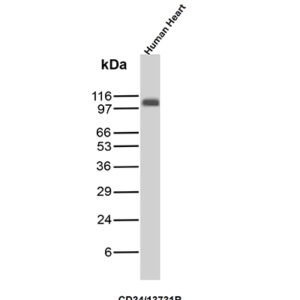 HPCA1 Antibody in Western Blot (WB)