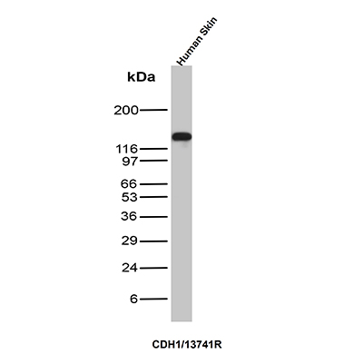 Western Blot Analysis of Human Skin tissue lysate using E-Cadherin Recombinant Rabbit Monoclonal Antibody (CDH1/13741R). E-Cadherin Antibody in Western Blot (WB)