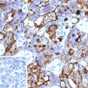 MUC16 / CA125 Antibody in Immunohistochemistry (IHC (P))