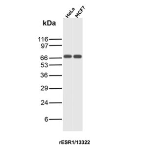 Estrogen Receptor alpha Antibody in Western Blot (WB)