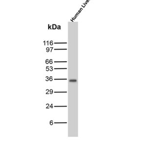 Arginase-1 Antibody in Western Blot (WB)