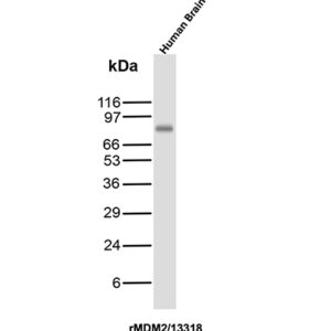 MDM2 Antibody in Western Blot (WB)