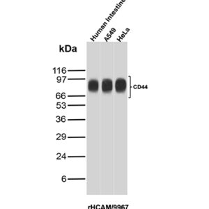 CD44v9 Antibody in Western Blot (WB)