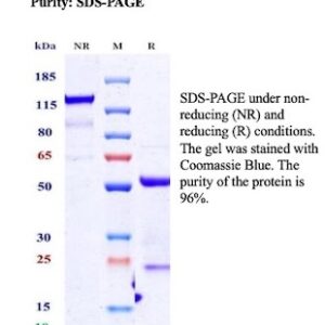 CALB1 (Calbindin 1) Antibody in SDS-PAGE