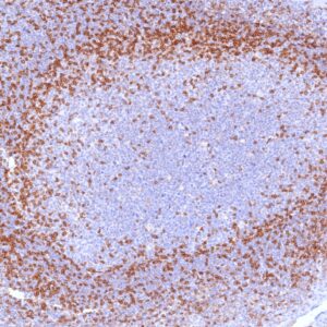 CD45RO Antibody in Immunohistochemistry (IHC (P))