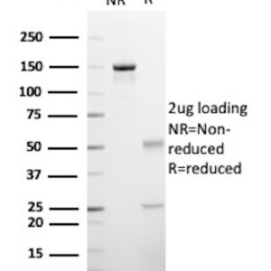ATP-binding cassette sub-family C member 4 / ABCC4 Antibody in SDS-PAGE