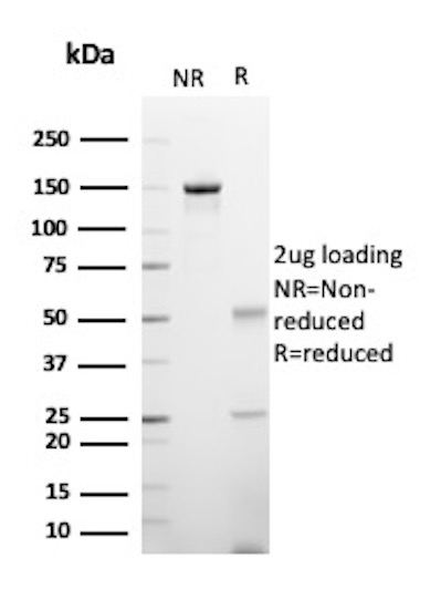 SDS-PAGE Analysis of Purified ATP-binding cassette sub-family C member 4 / ABCC4 Mouse Monoclonal Antibody (ABCC4/9029). Confirmation of Purity and Integrity of Antibody. ATP-binding cassette sub-family C member 4 / ABCC4 Antibody in SDS-PAGE