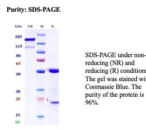 Calbindin 1 (CALB1) Antibody in SDS-PAGE