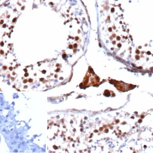 c-Myc Antibody in Immunohistochemistry (IHC (P))