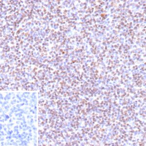 EBV Antibody in Immunohistochemistry (IHC (P))