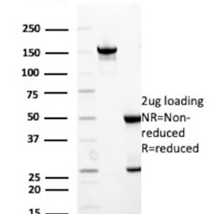 HBsAg Antibody in SDS-PAGE