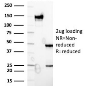 HBsAg Antibody in SDS-PAGE
