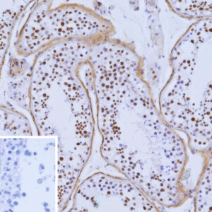 Wilm's Tumor 1 (WT1) Antibody in Immunohistochemistry (IHC (P))