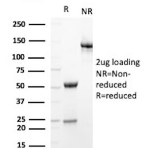 NES (Nestin) Antibody in SDS-PAGE