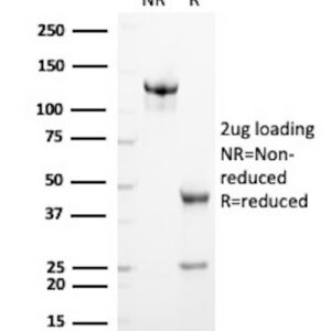 Inhibin, alpha Antibody in SDS-PAGE