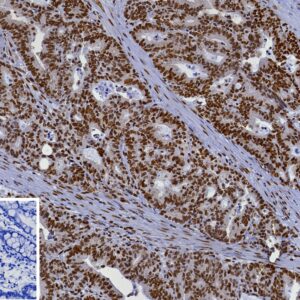 ATRX Antibody in Immunohistochemistry (IHC (P))