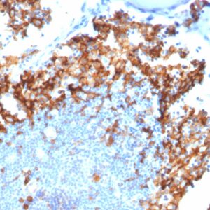 IL3RA Antibody in Immunohistochemistry (IHC (P))