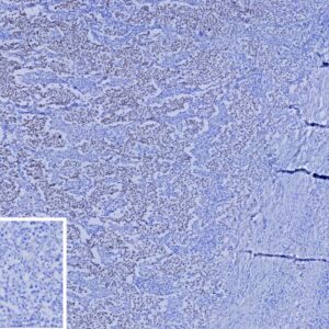 SALL4 Antibody in Immunohistochemistry (IHC (P))