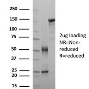 Parvalbumin Antibody in SDS-PAGE