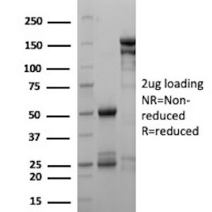 Parvalbumin Antibody in SDS-PAGE