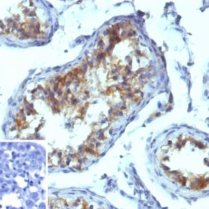 Alkaline Phosphatase Antibody in Immunohistochemistry (IHC (P))