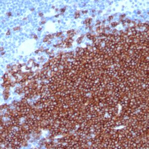 CD19 Antibody in Immunohistochemistry (IHC (P))