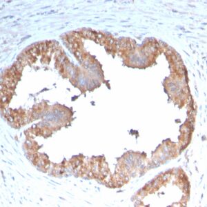 COX2 Antibody in Immunohistochemistry (IHC (P))
